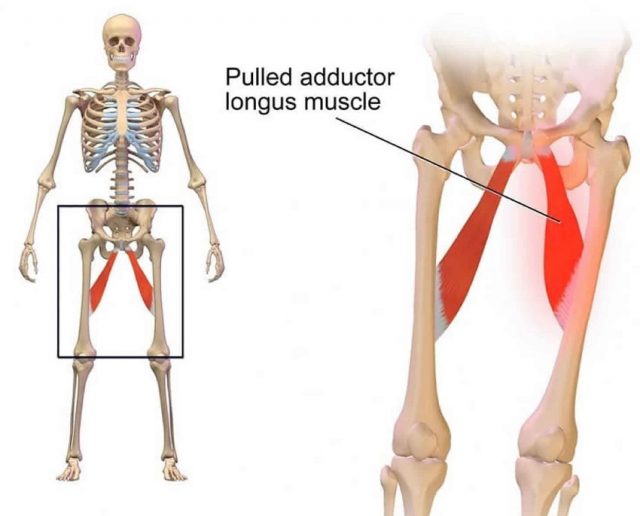 Adductor Injury Running Tips For Chubby People The Chubby Runner