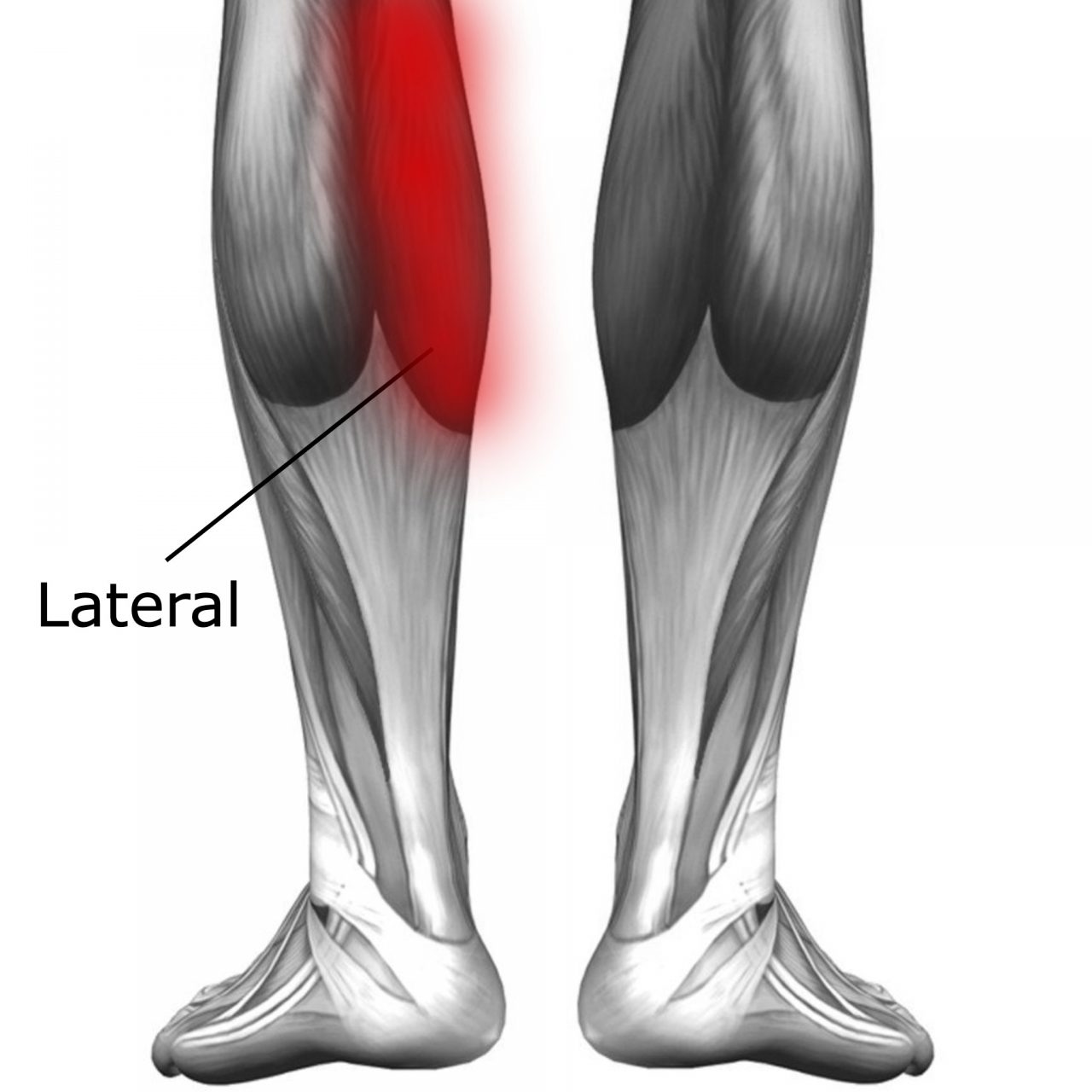 Calf Muscle Strain