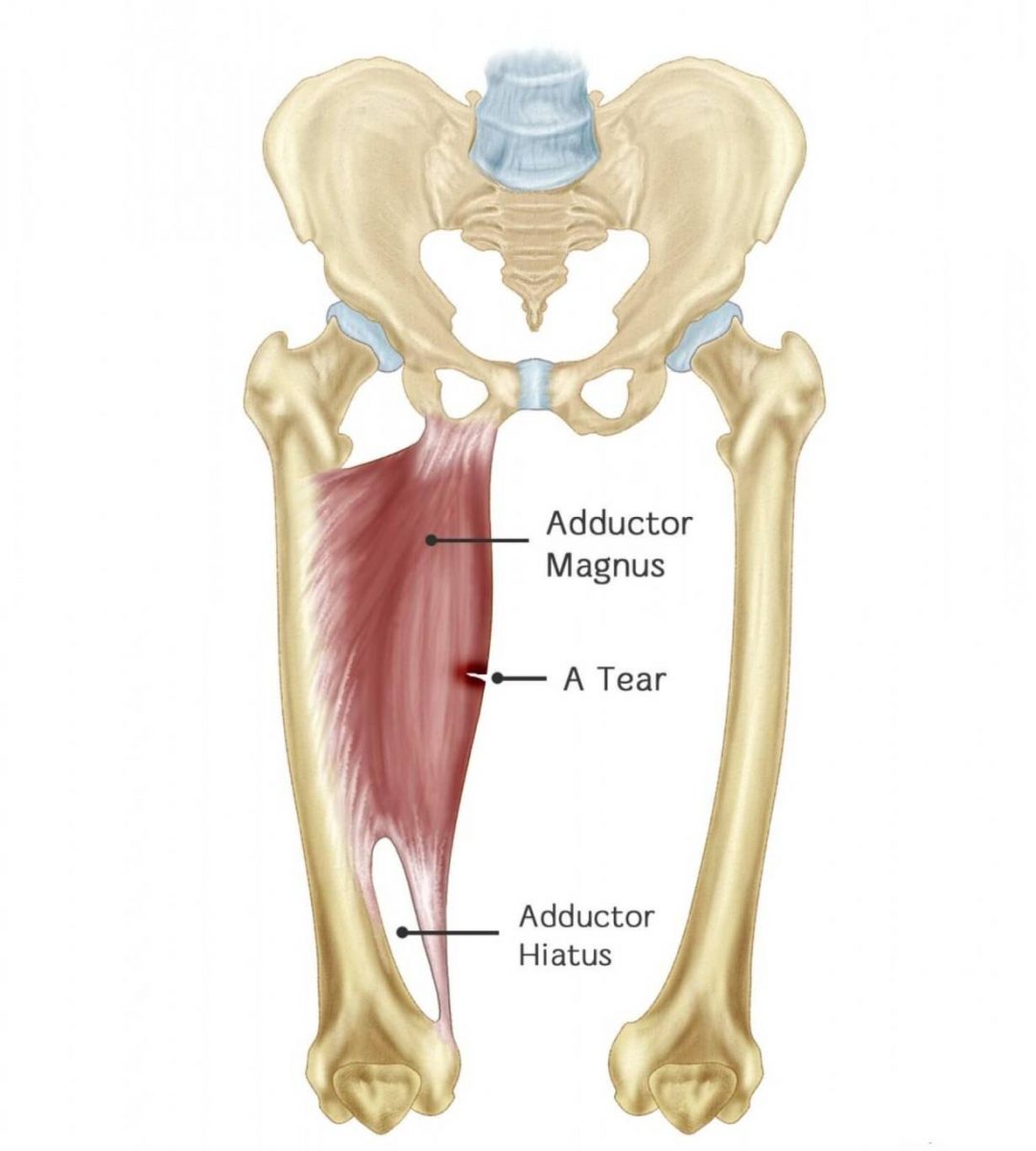 Adductor Magnus gracilis