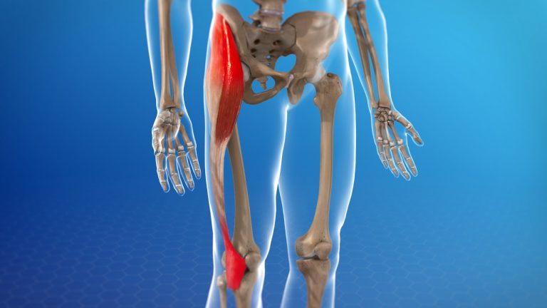 upper leg injury